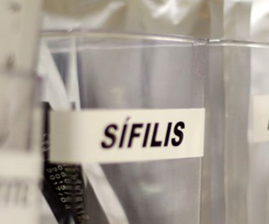 Sífilis continua em ritmo acelerado de crescimento no país