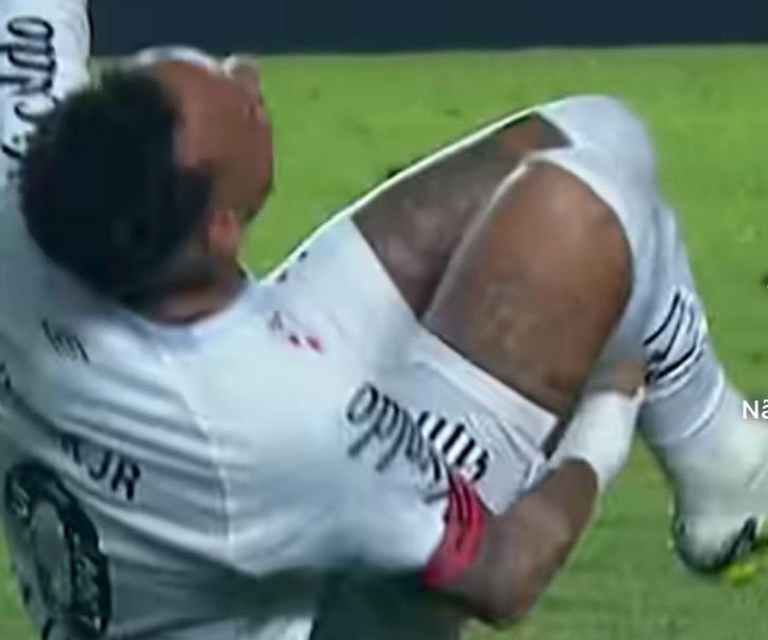 O zagueiro “assassino” que tentou pegar Neymar lembra Márcio, aquele que quebrou Zico em 1975