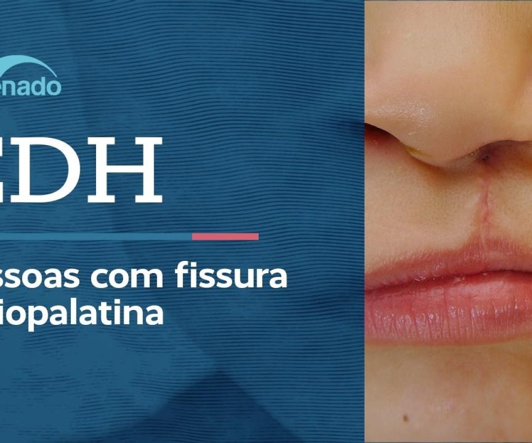 Vídeo: Ao vivo: CDH discute atenção integral para  fissura labiopalatina - 22/6/26
