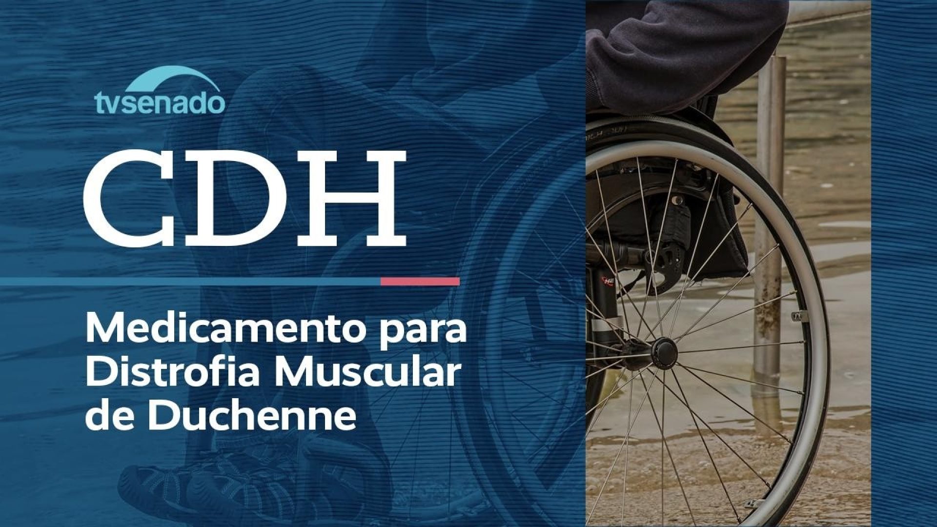 CDH debate tratamento para distrofia muscular de Duchenne – 27/8/26 — Senado Notícias
