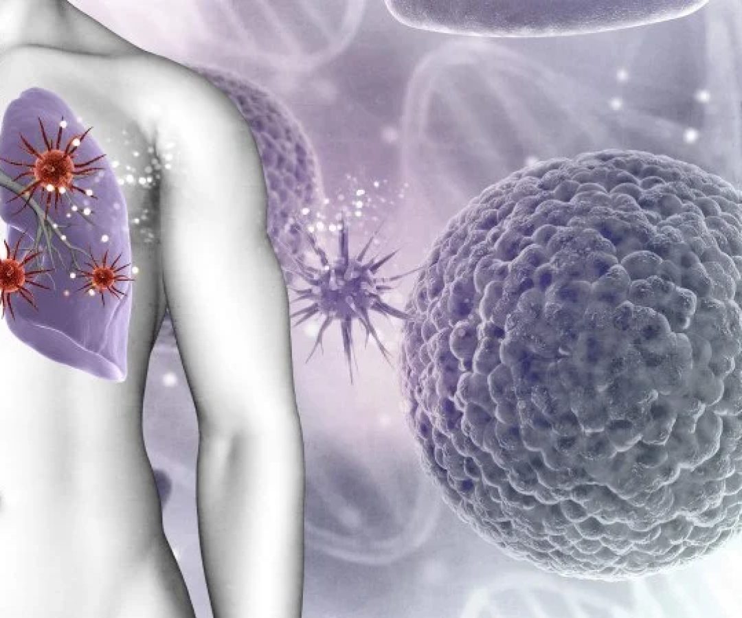 Fibrose cística     -  (crédito: Reprodução/Freepik)