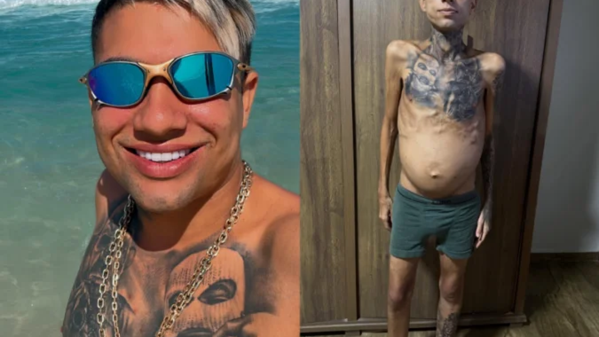 O influenciador Jota Surfista, antes e depois dos problemas de saúde -  (crédito: Reprodução/ Instagram / @jota_surfista)