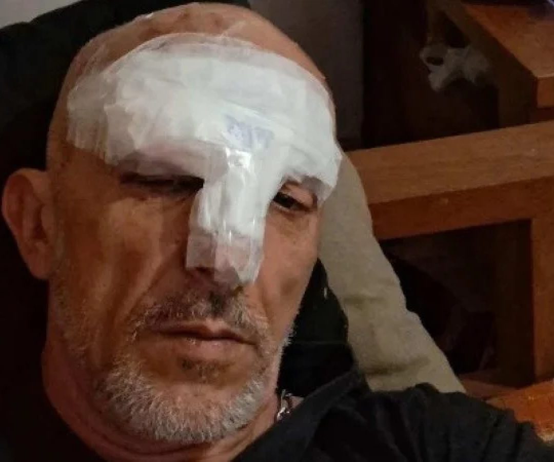 Cristian Cravinhos foi socorrido com ferimentos e elogiou a conduta dos policiais após o susto -  (crédito: Reprodução / Instagram )