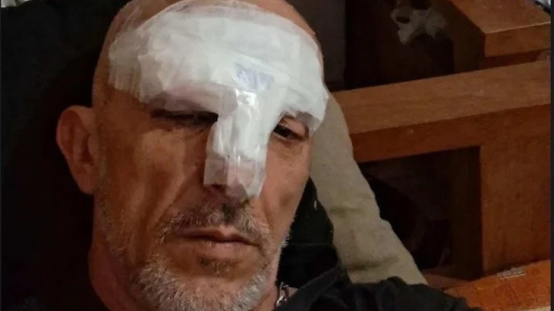 Cristian Cravinhos foi socorrido com ferimentos e elogiou a conduta dos policiais após o susto -  (crédito: Reprodução / Instagram )