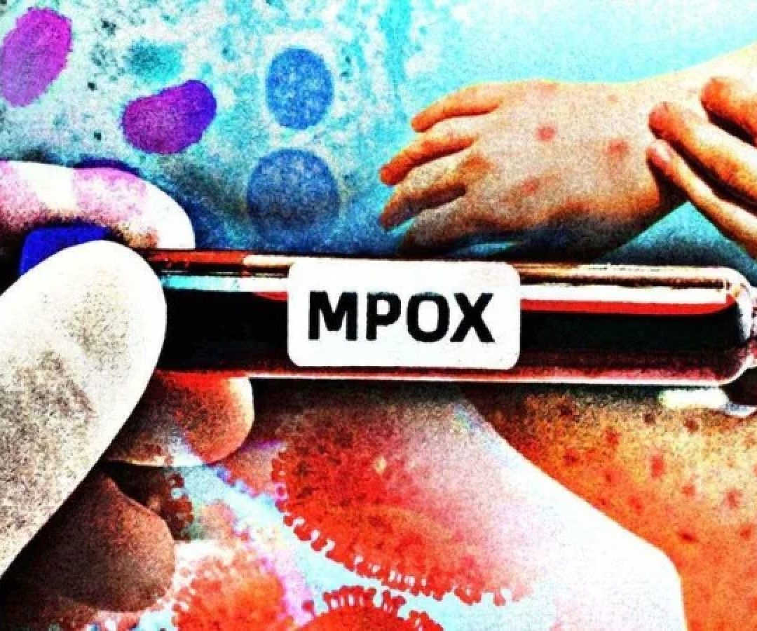 Entre as demais medidas preventivas estão a higienização frequente das mãos, a não utilização compartilhada de objetos pessoais e o uso de máscaras em situações de maior risco -  (crédito: Maurenilson Freire)