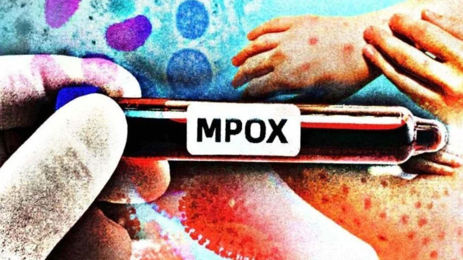 Entre as demais medidas preventivas estão a higienização frequente das mãos, a não utilização compartilhada de objetos pessoais e o uso de máscaras em situações de maior risco -  (crédito: Maurenilson Freire)