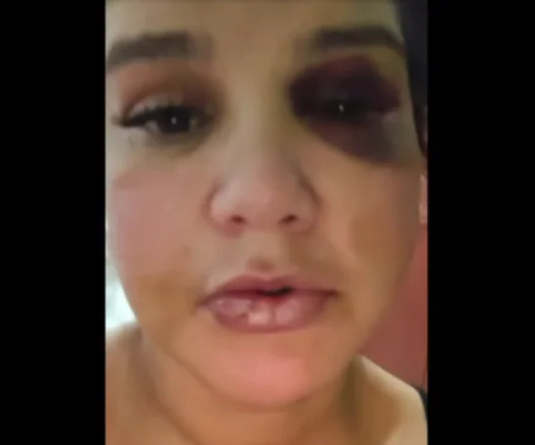 Fabrícia de Freitas Soares Madeira, de 36 anos, denunciou o companheiro à polícia e publicou vídeo nas redes sociais -  (crédito: Redes sociais/Reprodução)