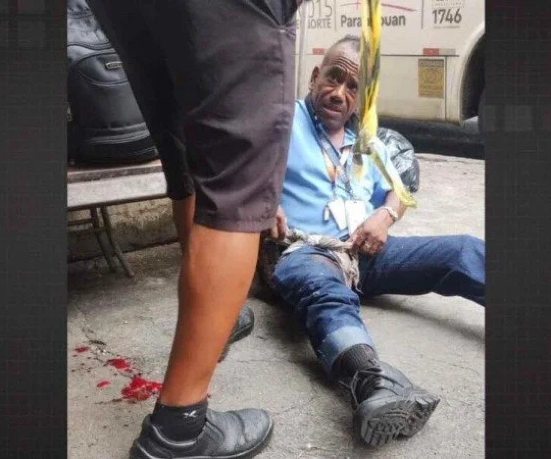Granada explode na Ilha do Governador e deixa 6 feridos, 2 em estado grave -  (crédito: Tupi)