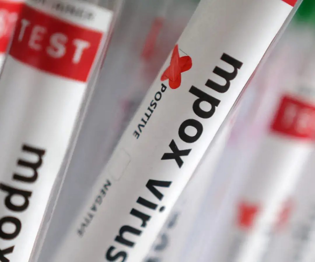 Sobe para 140 número de casos confirmados de Mpox no país, em 2026