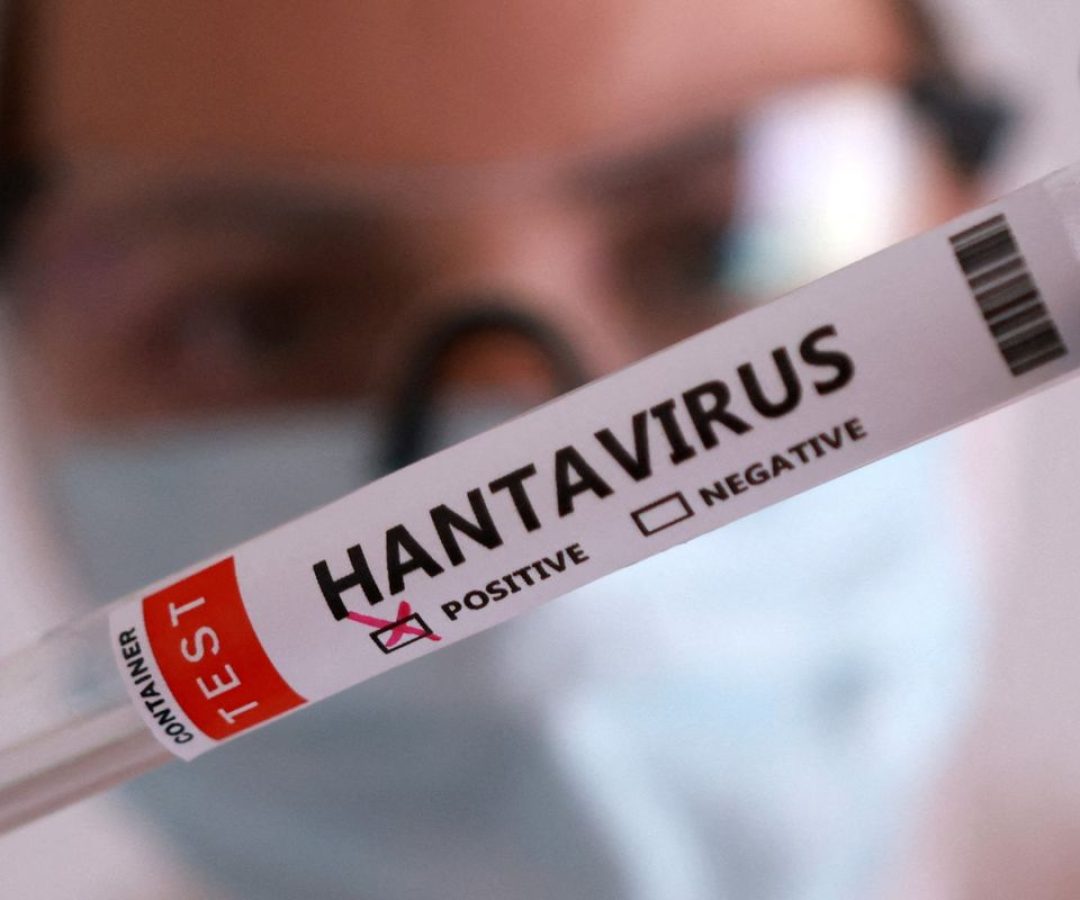Duas pessoas retiradas de navio testam positivo para o hantavírus