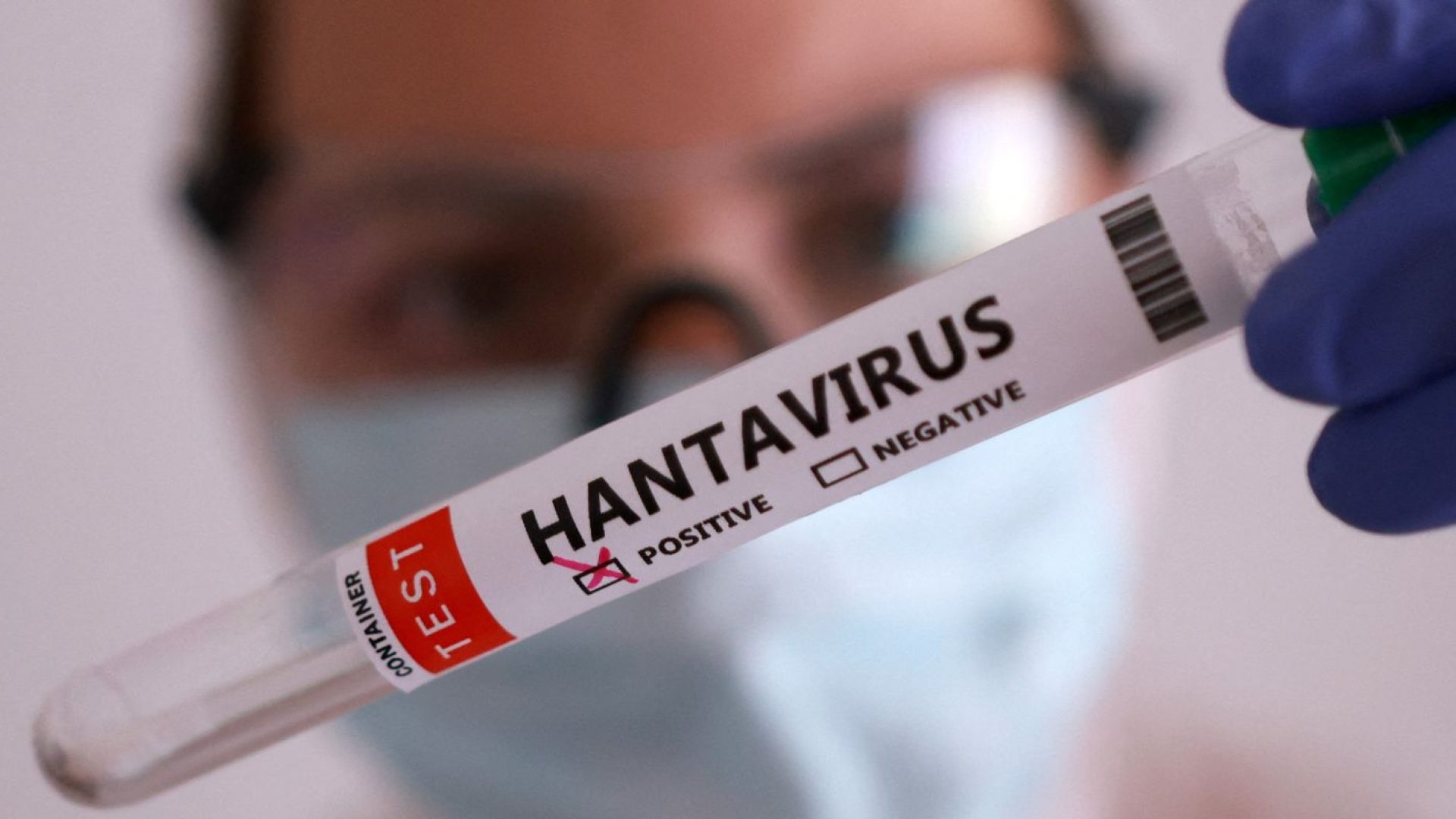 Duas pessoas retiradas de navio testam positivo para o hantavírus