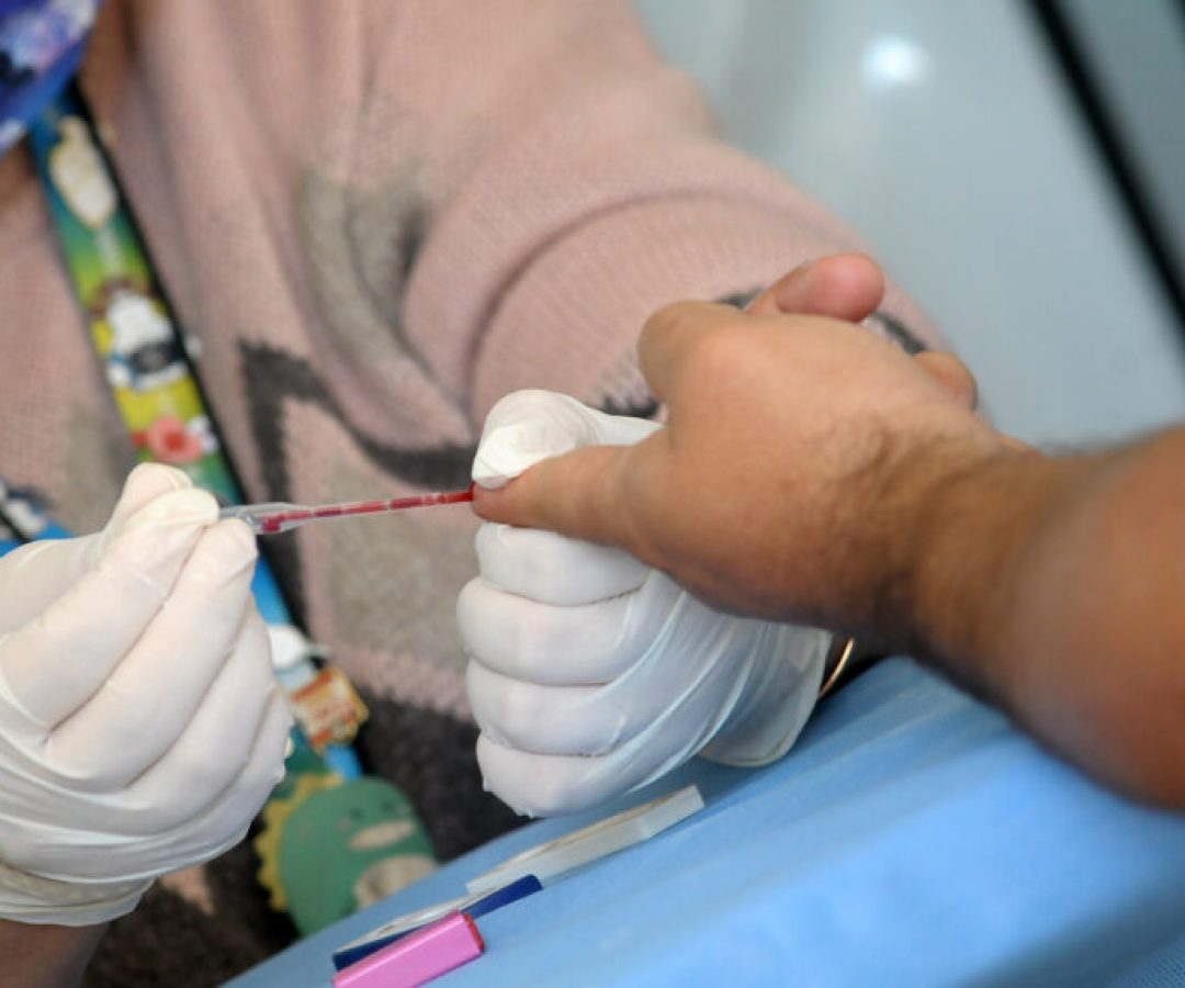 Casos de sífilis diminuem no Distrito Federal
