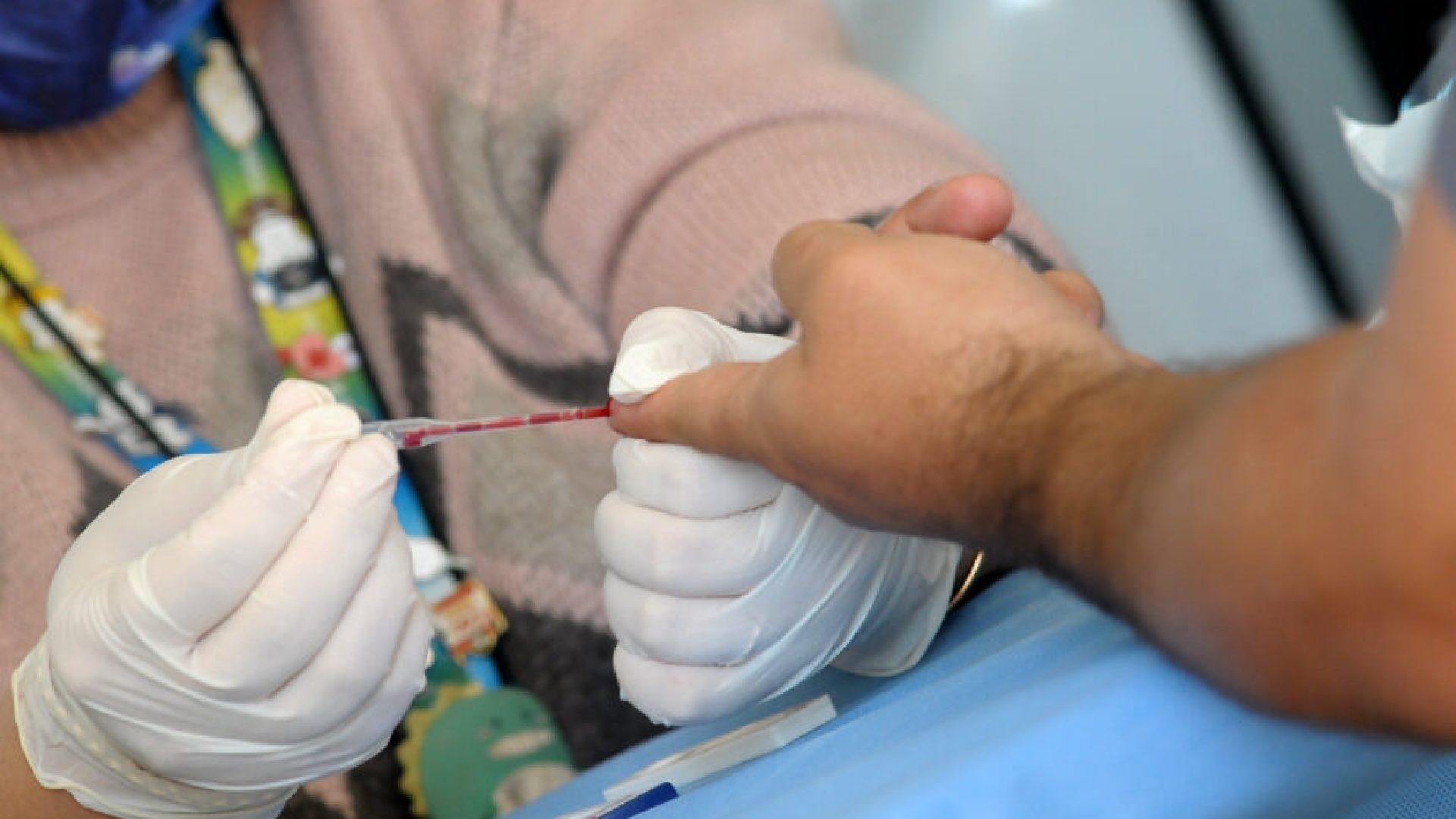 Casos de sífilis diminuem no Distrito Federal