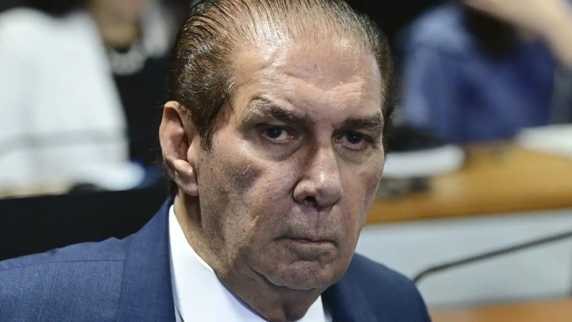 Senador Jader Barbalho tem alta hospitalar depois de 4 dias internado