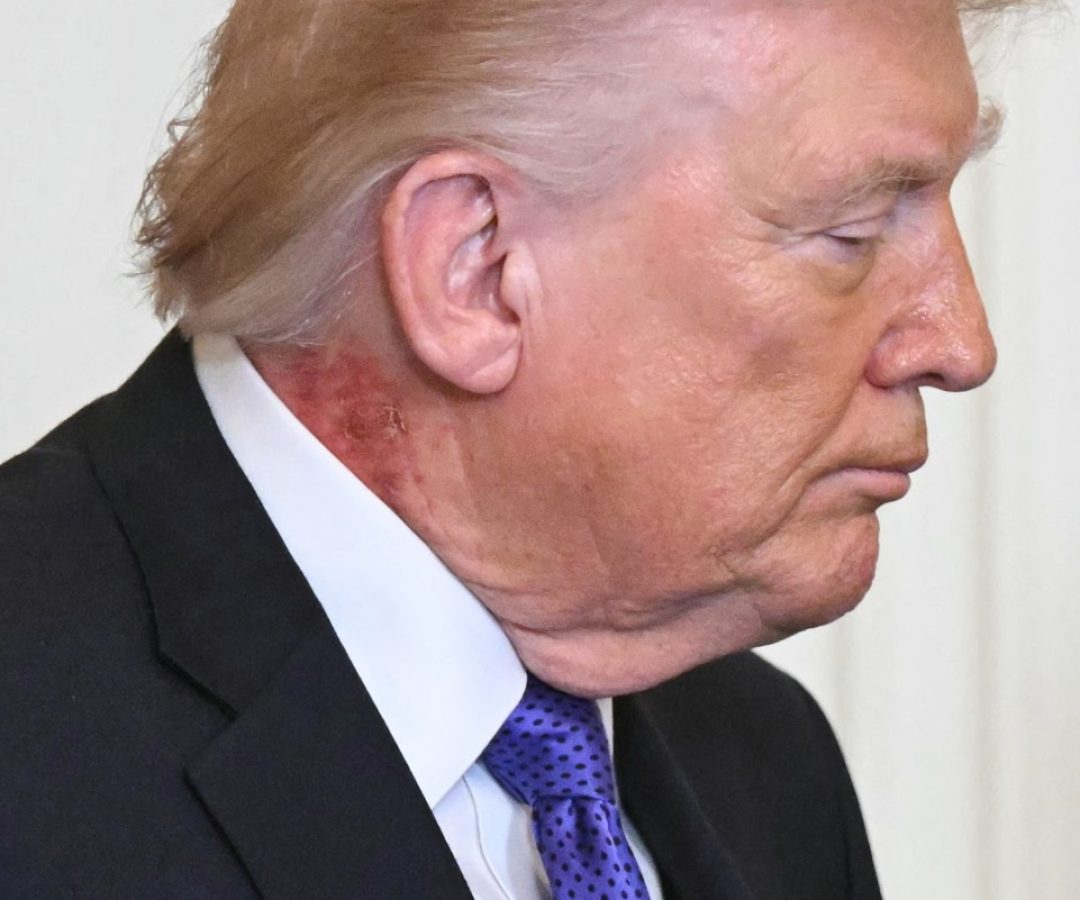AFP__20260302__99M79NH__v3__MidRes__TopshotUsPoliticsTrump.jpg