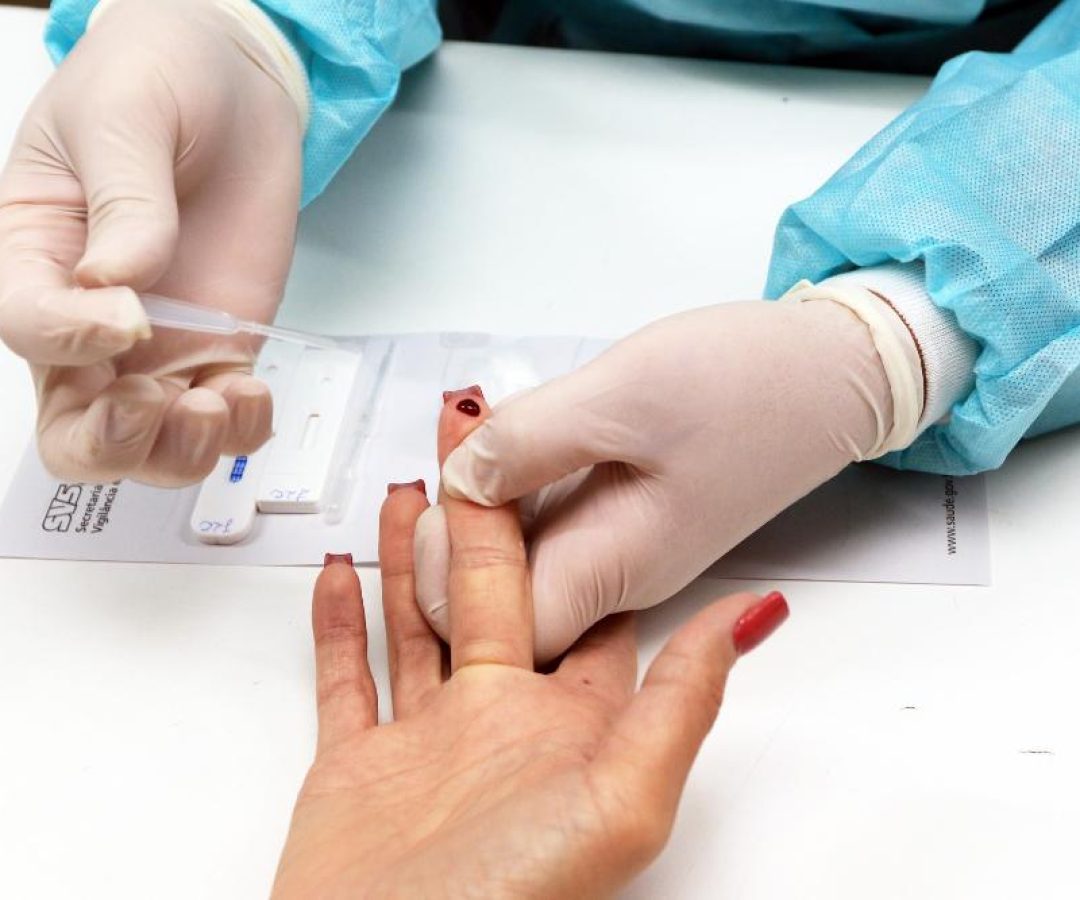 Luta contra o HIV: SCS recebe testagem rápida na segunda-feira