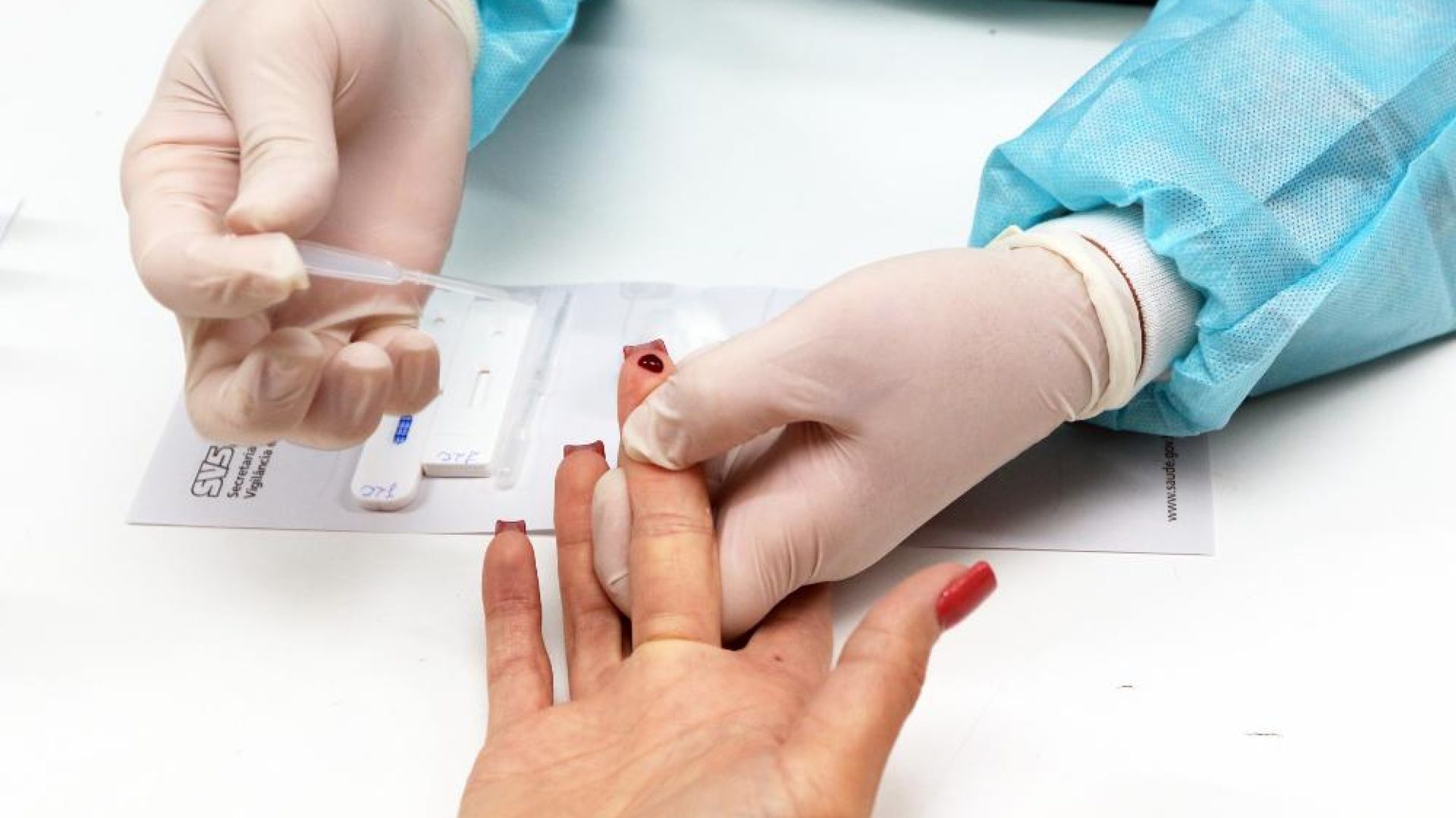 Luta contra o HIV: SCS recebe testagem rápida na segunda-feira