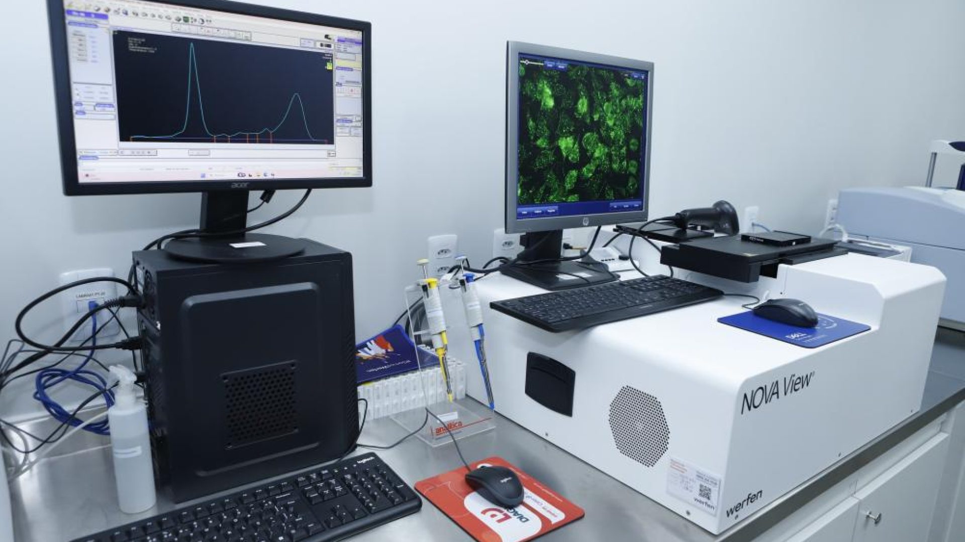 Hospital Regional de Taguatinga ganha central para exames especializados