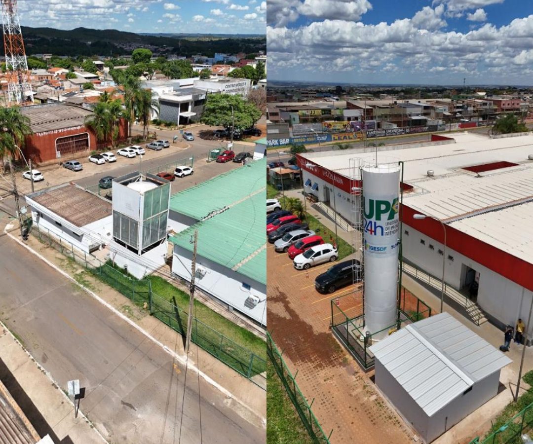 UPAs do Distrito Federal são modernizadas com obras estruturais