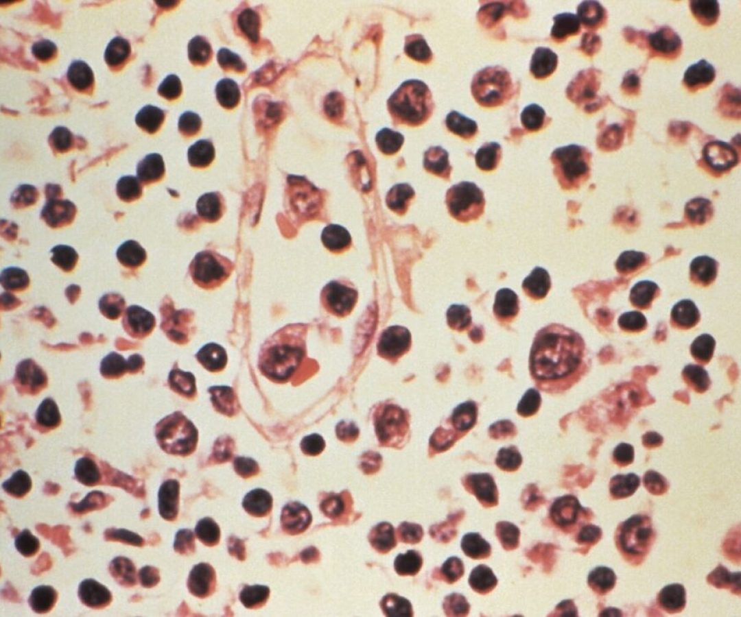 afp-20260506-a9za6cu-v1-midres-ushealthhantavirus.jpg