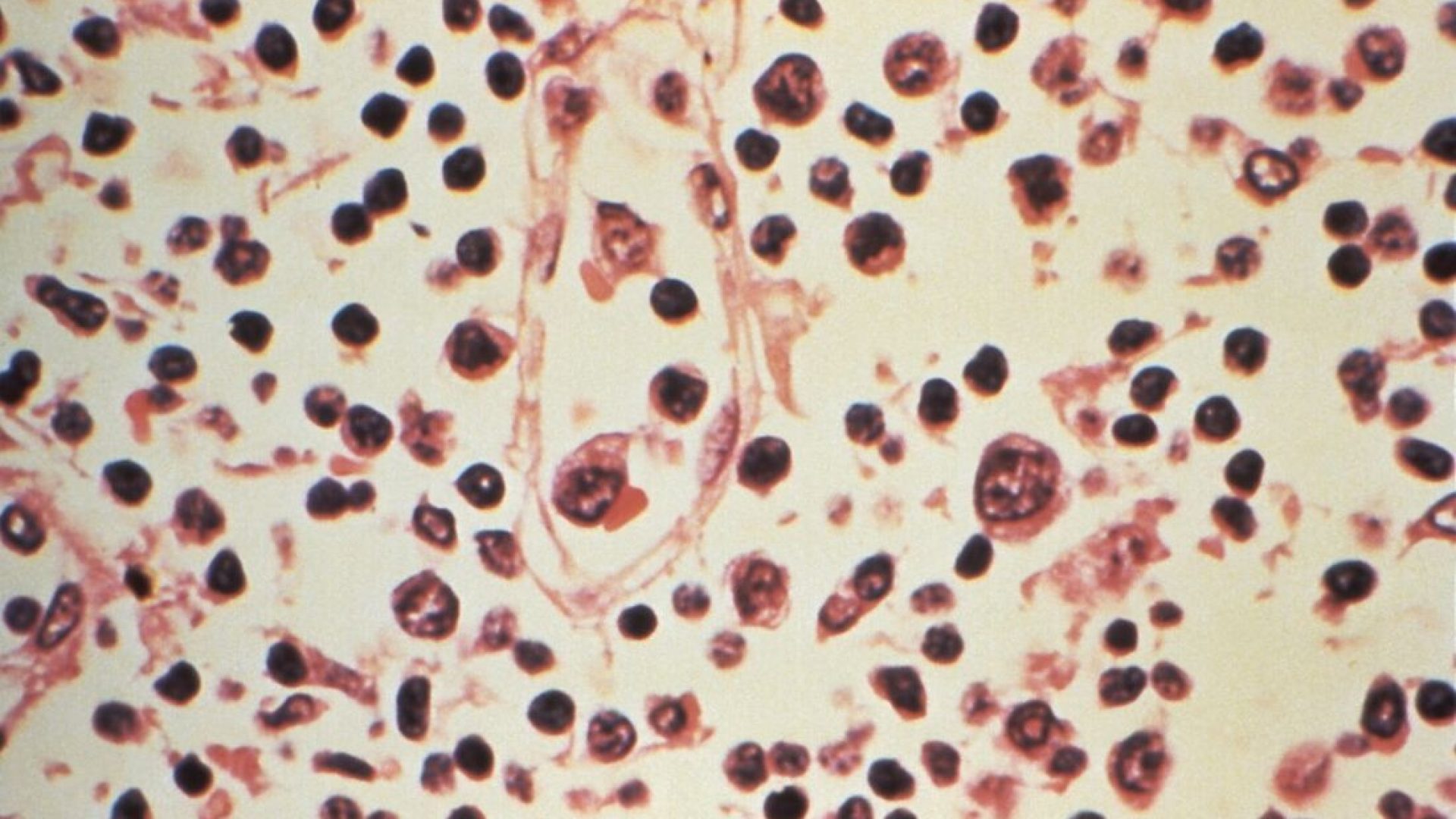 afp-20260506-a9za6cu-v1-midres-ushealthhantavirus.jpg