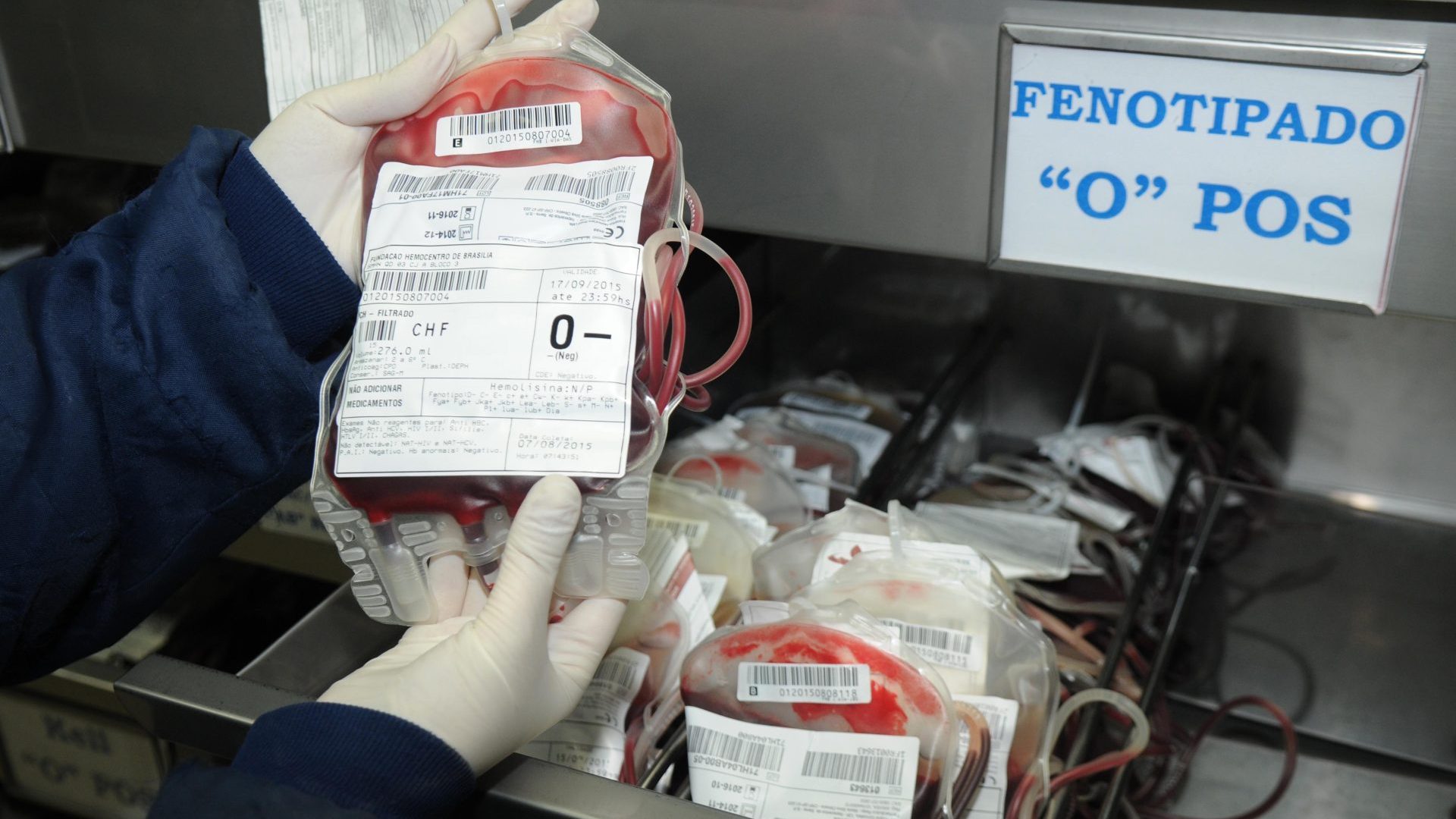 Hemocentro leva unidade móvel a Ceilândia em ação do Outubro Rosa na Casa da Mulher Brasileira