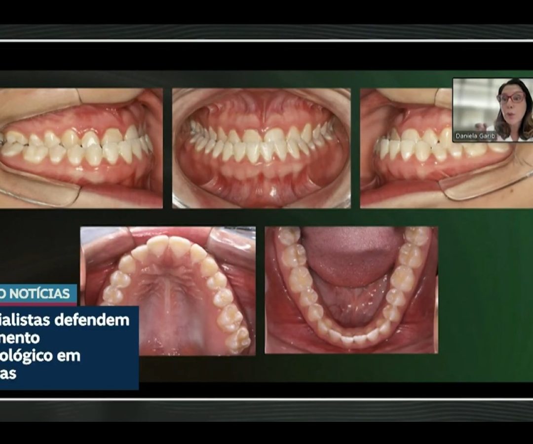 Dentistas defendem tratamento de problemas ortodônticos na infância — Senado Notícias