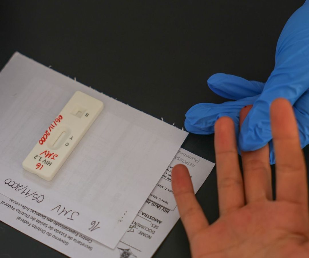 HIV/Aids: Brasil vai insistir em acordo por PrEP de longa duração