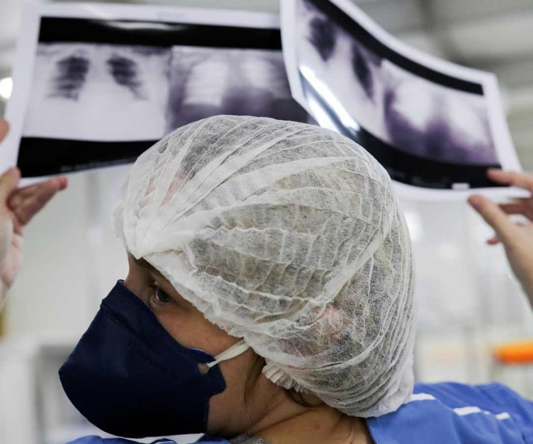 Brasil deve ter 781 mil novos casos de câncer por ano até 2028