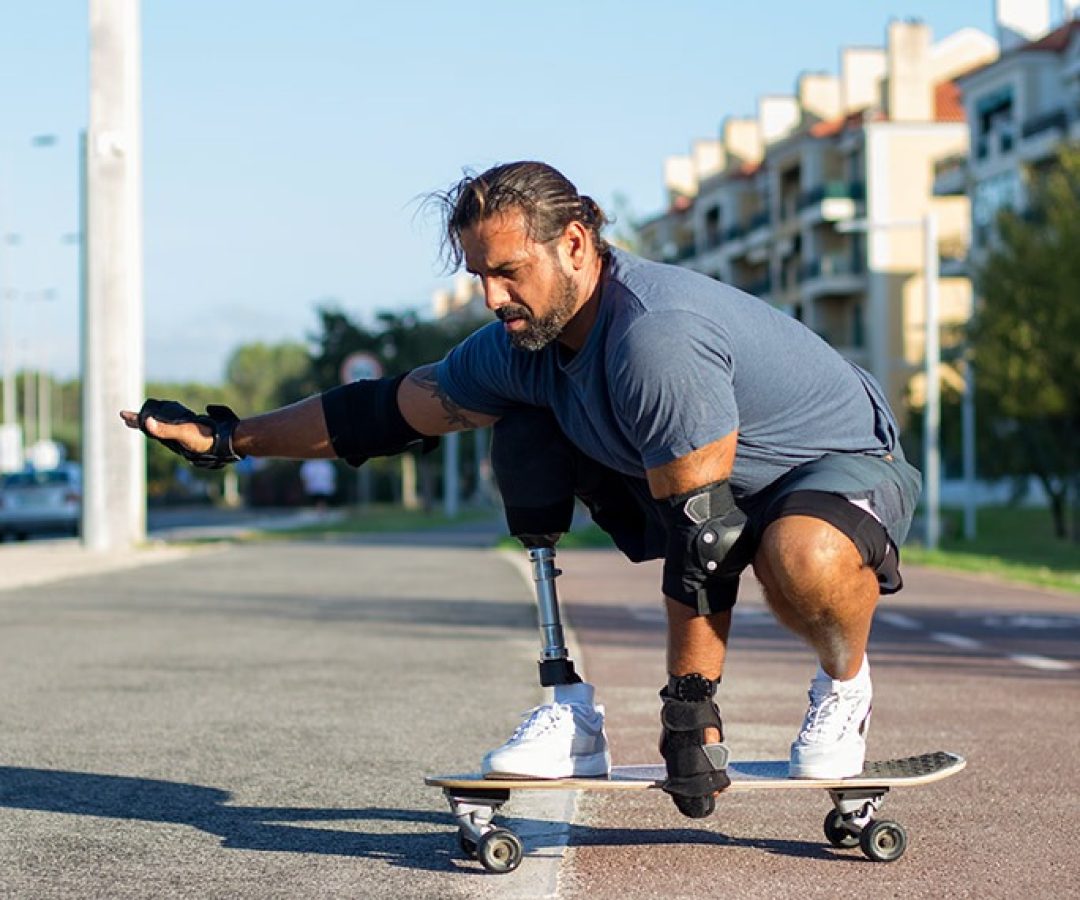 Dia de conscientização sobre ausência de membros, em 25 de agosto, vira lei — Senado Notícias