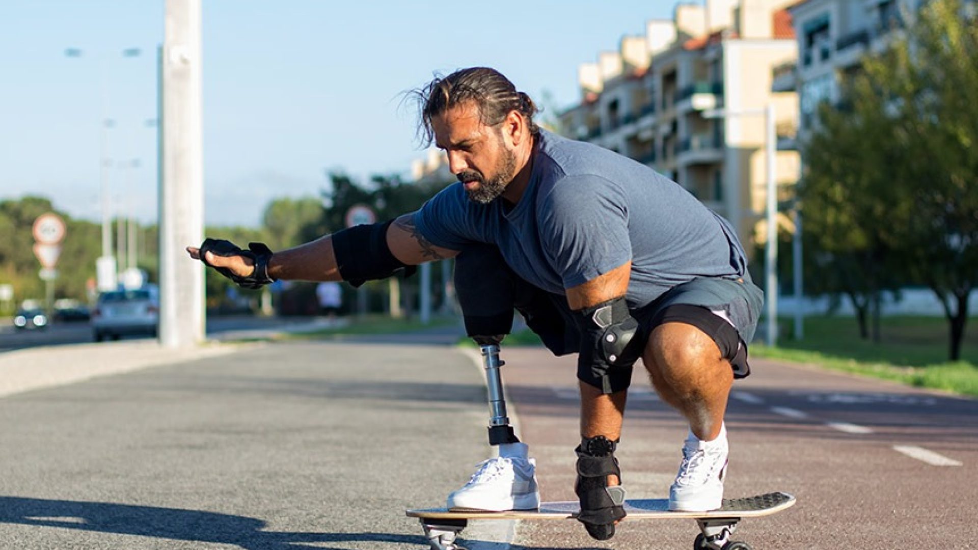 Dia de conscientização sobre ausência de membros, em 25 de agosto, vira lei — Senado Notícias